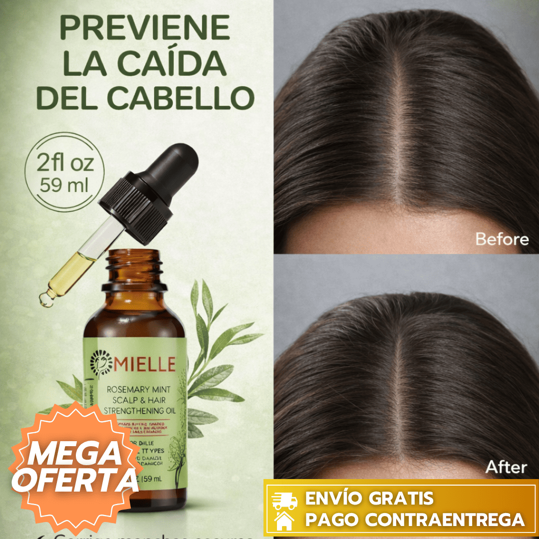 SerumMielle™: Sérum capilar que fortalece, nutre y ayuda a estimular el crecimiento del cabello. 💆‍♀️✨